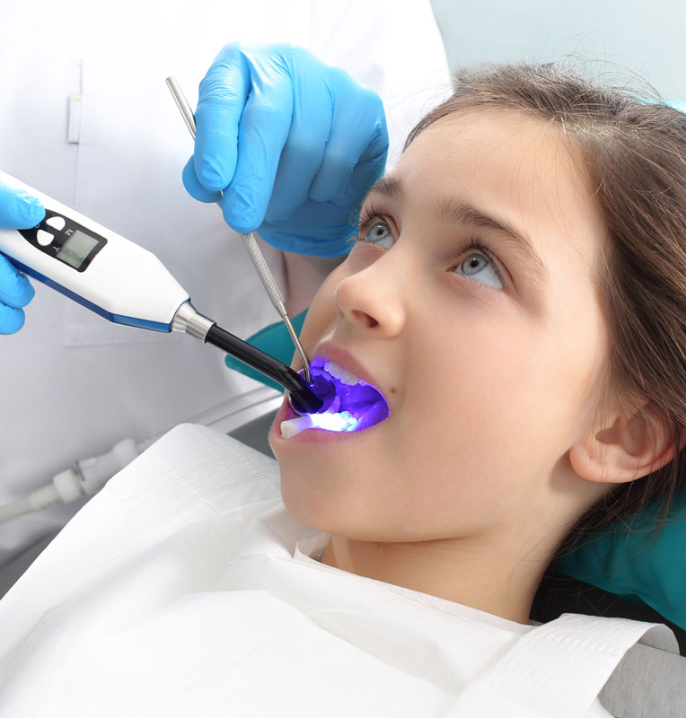 Child receiving laser dental treatment with a blue light device in a pediatric dental office, showcasing advanced laser technology for a comfortable experience.